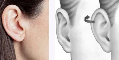 Cirugía de orejas